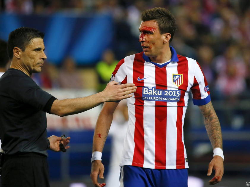 Atlético-Stürmer Mandžukić zog sich eine Kopfwunde zu