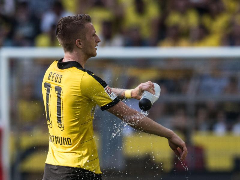 Borussia Dortmund hofft, dass Marco Reus gegen Bayer Leverkusen wieder spielen kann