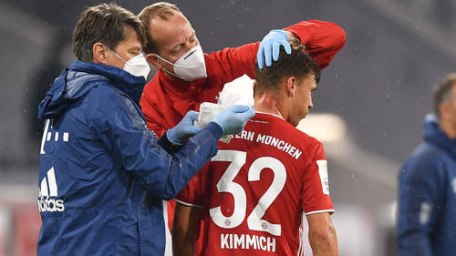 Joshua Kimmich muss wegen einer Platzwunde behandelt werden