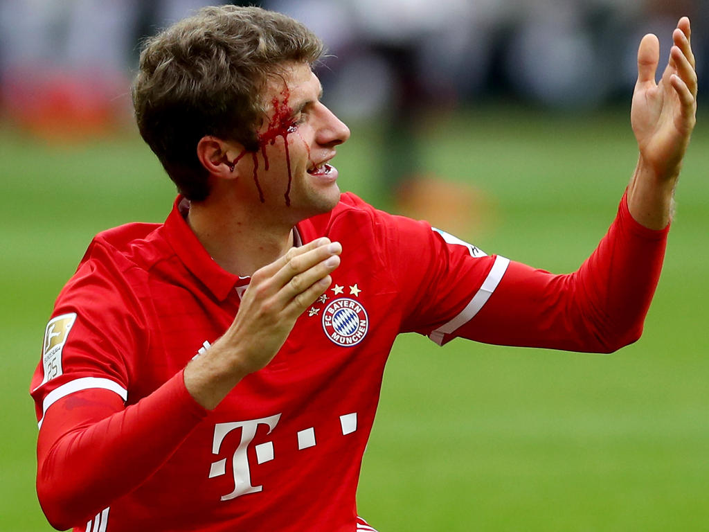 Bayerns Thomas Müller holte sich im Spiel eine blutende Wunde ab