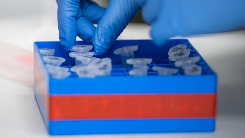 Auch an der Charité Berlin Mitte wird das Coronavirus erforscht Auch an der Charité Berlin Mitte wird das Coronavirus erforscht