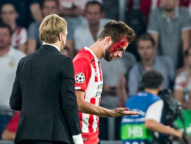 Davy Pröpper verlaat een fiks bloedende hoofdwond het veld tijdens het duel tussen PSV en Atlético Madrid. De middenvelder kan daardoor een strafschop niet nemen. (13-09-2016)