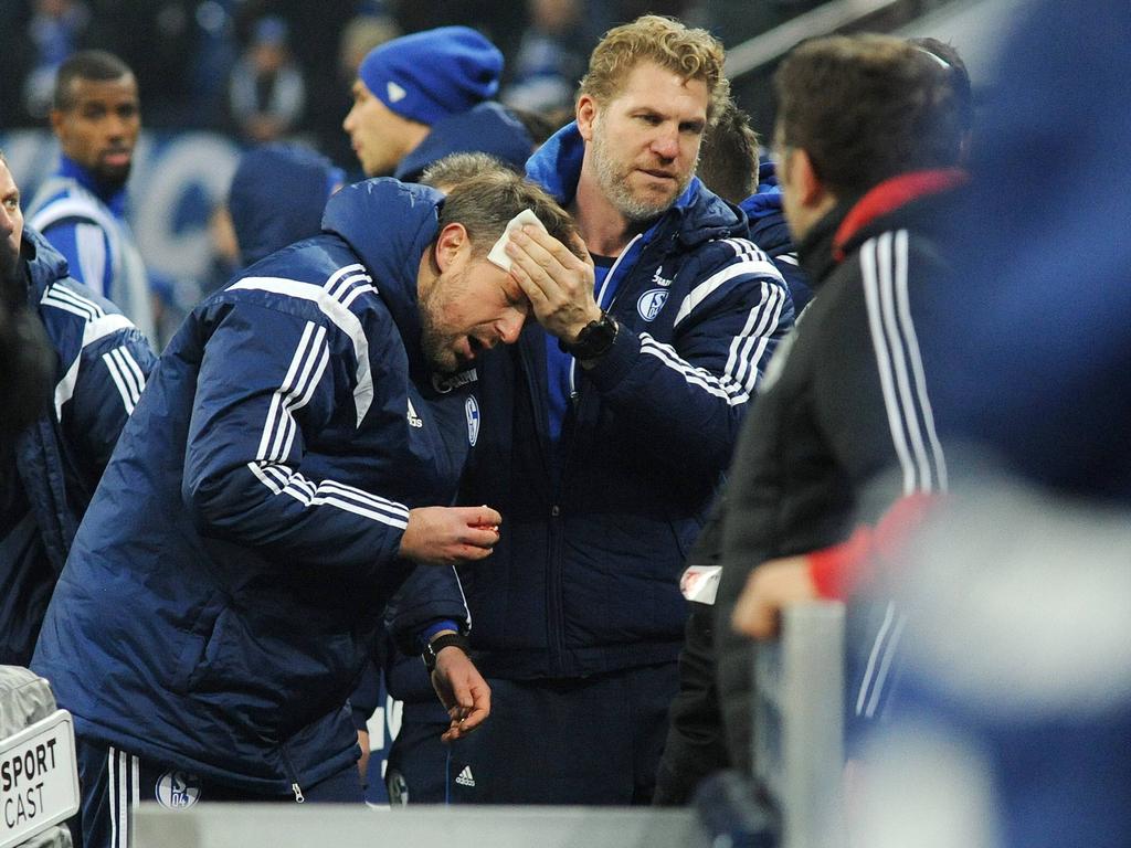 Schalkes Sven Hübscher wurde während der Bundesligapartie gegen Köln von einem Feuerzeug getroffen