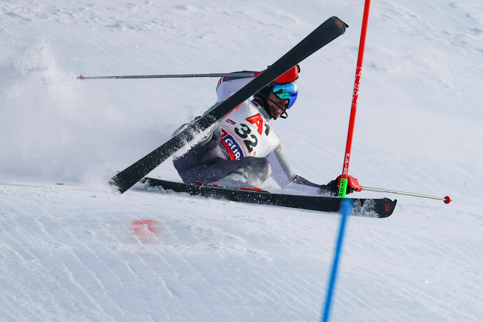 Marcel Hirscher hat sich schwer verletzt